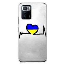 Силиконовый Чехол на Xiaomi POCO X3 GT (Я-Украина) – Украинская кардиограмма