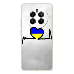 Силиконовый Чехол на RealMe 12 (Я-Украина) – Украинская кардиограмма