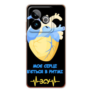 ЗСУ Чехлы (TPU) для Realme GT 7 – Ритм ЗСУ