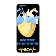 ЗСУ Чехлы (TPU) для Realme GT (Ритм ЗСУ)