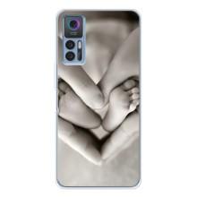 Чохли для МАМИ на TCL 30 Plus – Люблячі долоні