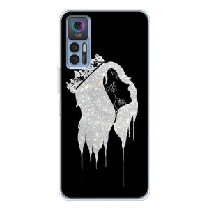 Чохол з Короною 30 Плюс - (AlphaPrint)