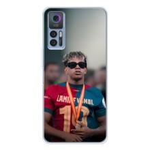 Чохол з футболістом Ламін Ямаль TCL 30 Plus – Ямаль Барса