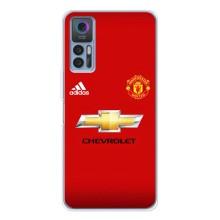 Силиконовые Чехлы принт Футбол на TCL 30 Plus – Man United