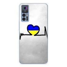 Силиконовый Чехол на TCL 30 Plus (Я-Украина) – Украинская кардиограмма