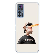 Чехлы с Обезьянами NFT для TCL 30 (AlphaPrint) (обезьяна NFT в очках)