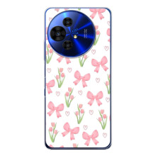 Чохол з бантиками на ТЕСІ 50 НХТПепер – Банти і квіти