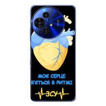 ЗСУ Чехлы (TPU) для TCL 50 NxtPaper