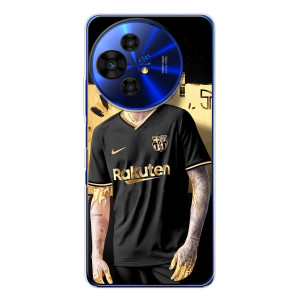 Силіконовий Чохол для TCL 50 Pro NxtPaper – Gold Neymar