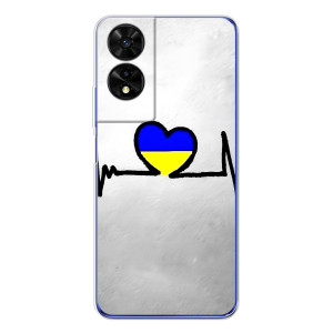 Силиконовый Чехол на TCL 505 (Я-Украина) – Украинская кардиограмма
