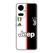 Чохли для TECNO Camon 19 (CI6n) / 19 Pro (CI8n) (VPrint) - Футбольні клуби (Juventus)