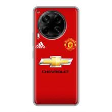 Силиконовые Чехлы принт Футбол на Tecno Camon 30 (CL6) – Man United