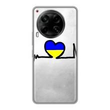 Силиконовый Чехол на Tecno Camon 30 (CL6) (Я-Украина) – Украинская кардиограмма