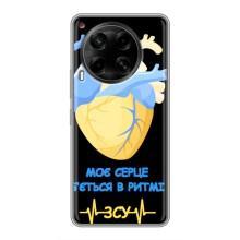 ЗСУ Чехлы (TPU) для Tecno Camon 30 (CL6) – Ритм ЗСУ