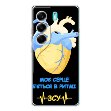 ЗСУ Чехлы (TPU) для TECNO Camon 40 (Ритм ЗСУ)