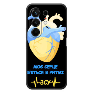 ЗСУ Чехлы (TPU) для TECNO Camon 50