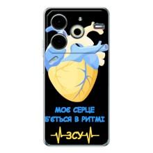 ЗСУ Чехлы (TPU) для Tecno Pova 6 Neo 5G – Ритм ЗСУ