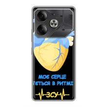 ЗСУ Чохли (TPU) для Tecno Pova 6 – Ритм ЗСУ