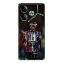Чехол с футболистом Ламин Ямаль Tecno Pova 7 (Ямал с кубком)