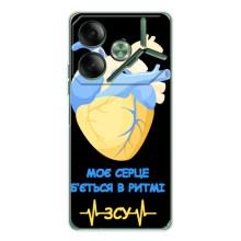 ЗСУ Чехлы (TPU) для Tecno Pova 7 – Ритм ЗСУ