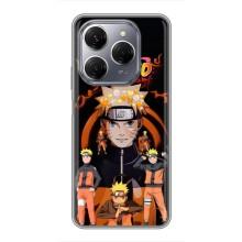 Naruto Anime Чехлы для Техно Спарк 20 Про (AlphaPrint)