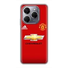 Силиконовые Чехлы принт Футбол на TECNO Spark 20 Pro – Man United