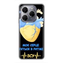 ЗСУ Чехлы (TPU) для TECNO Spark 20 Pro – Ритм ЗСУ