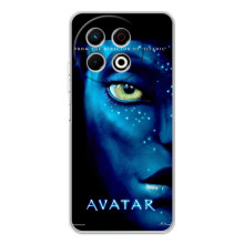 Чехлы с фильма АВАТАР для TECNO Spark 30 Pro (AlphaPrint) – глаз Аватара