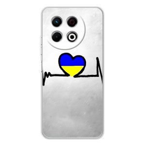 Силиконовый Чехол на TECNO Spark 30 Pro (Я-Украина) – Украинская кардиограмма