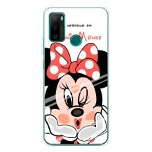 Эксклюзивный чехол для Ulefone Note 10P (AlphaPrint - Мультяшные) (Маус Минни)
