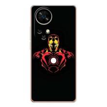 Чехлы с героями Марвел Ulefone Note 17 Pro (VPrint)