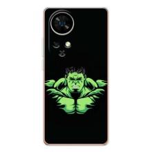 Чехлы с героями Марвел Ulefone Note 17 Pro (VPrint)