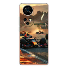 Чехол фильм Формула 1 для Ulefone Note 17 Pro – Чемпионат ф1