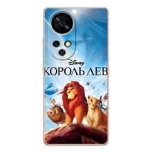 Чехол Король лев на Нот 17 Про – Король лев