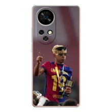 Чохол з футболістом Ламін Ямаль Ulefone Note 17 Pro