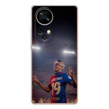 Чехол с футболистом Ламин Ямаль Ulefone Note 17 Pro – Ямаль на стадионе