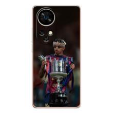 Чехол с футболистом Ламин Ямаль Ulefone Note 17 Pro – Ямал с кубком