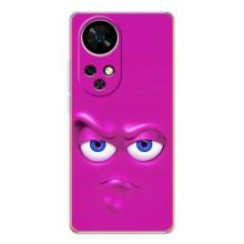 Чохли (ТПУ) (смішні стікери) для Ulefone Note 17 Pro – Хитра мордочка