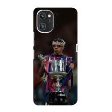 Чохол з футболістом Ламін Ямаль Umidigi A13 Pro – Ямал з кубком