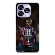 Чехол с футболистом Ламин Ямаль UMIDIGI A15 (Ямал с кубком)