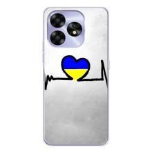 Силіконовий Чохол  на UMIDIGI A15 (Я-Україна) – Українська кардіограма