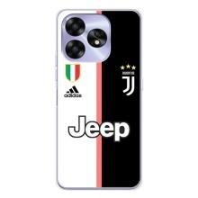 Чохли для UMIDIGI A15C (VPrint) - Футбольні клуби (Juventus)