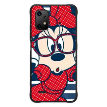 Эксклюзивный чехол для UMiDiGi Bison X20 (AlphaPrint - Мультяшные) (Маус в очках)