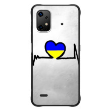 Силіконовий Чохол  на UMiDiGi Bison X20 (Я-Україна) (Українська кардіограма)