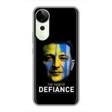 Чехол для Vivo T3 Ultra (AlphaPrint - с принтом Зеленского) – В. Зеленский