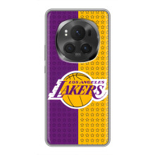 Чехлы с топовыми принтами для АйВиВи Х200 ПРО (Лейкерс)