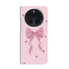 Чехол банты для ViVO X300s – Бант на розовом