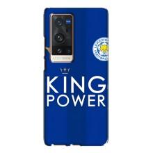 Чохли для Vivo X60 Pro Plus (VPrint) - Футбольні клуби (Lester)