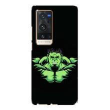 Чехлы с героями Марвел Vivo X60 Pro Plus (VPrint)