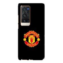 Чохол Манчестер Юнайтед для ВіВО X60 Про Плюс (AlphaPrint) (ФК Манчестер Юнайтед)